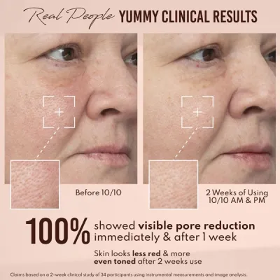 Danessa Myricks Beauty Yummy Skin 10/10 Barrier Boost Hyaluronic Acid + Ectoin Plumping Serum